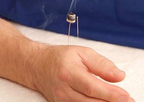 Akupunktur Duft